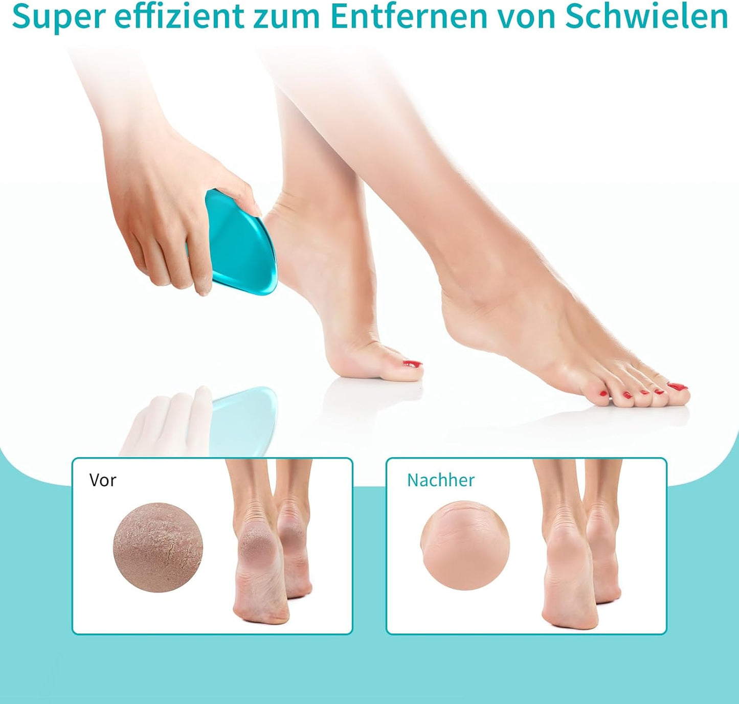 Anjocare 2In1 Nano Glas Hornhautentferner,Hochwirksame Hornhaut Entfernung Für Nass&Trocken Füsse,Professionelle Hornhautfeile Hornhautraspel Zur Fußpflege Sicher&Schnell Hornhautentfernung (Blau)
